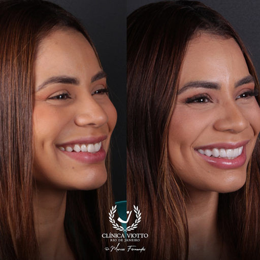 Odontologia funcional estética contemporânea