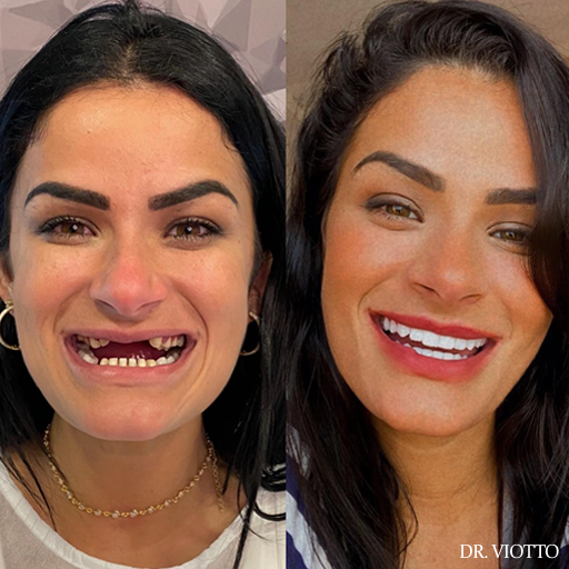 Reabilitação Oral Viotto Estética
