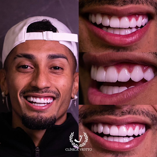 Sorriso estético