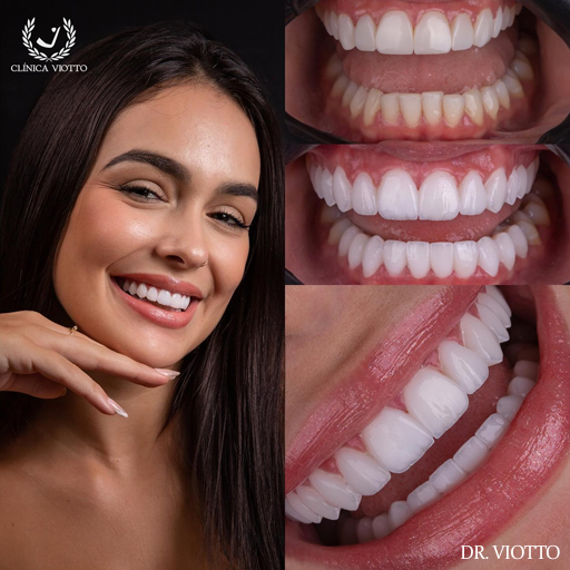 Transformação do sorriso com resultado natural e rápido